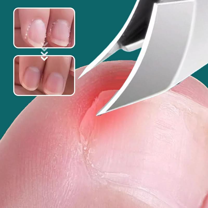 🔥Hot sale 50% korting🔥Anti-splash schuine rand nagelklem 3-delige set
