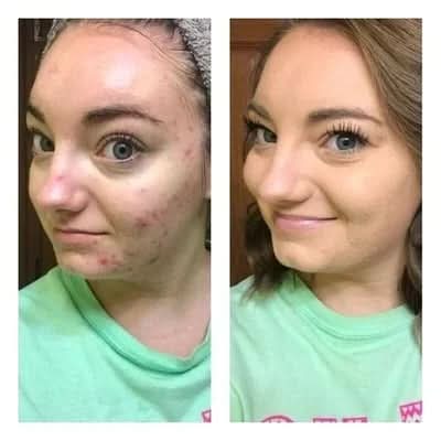 🔥🔥Tricolor Concealer🎁Koop 1 krijg 1 gratis🎁